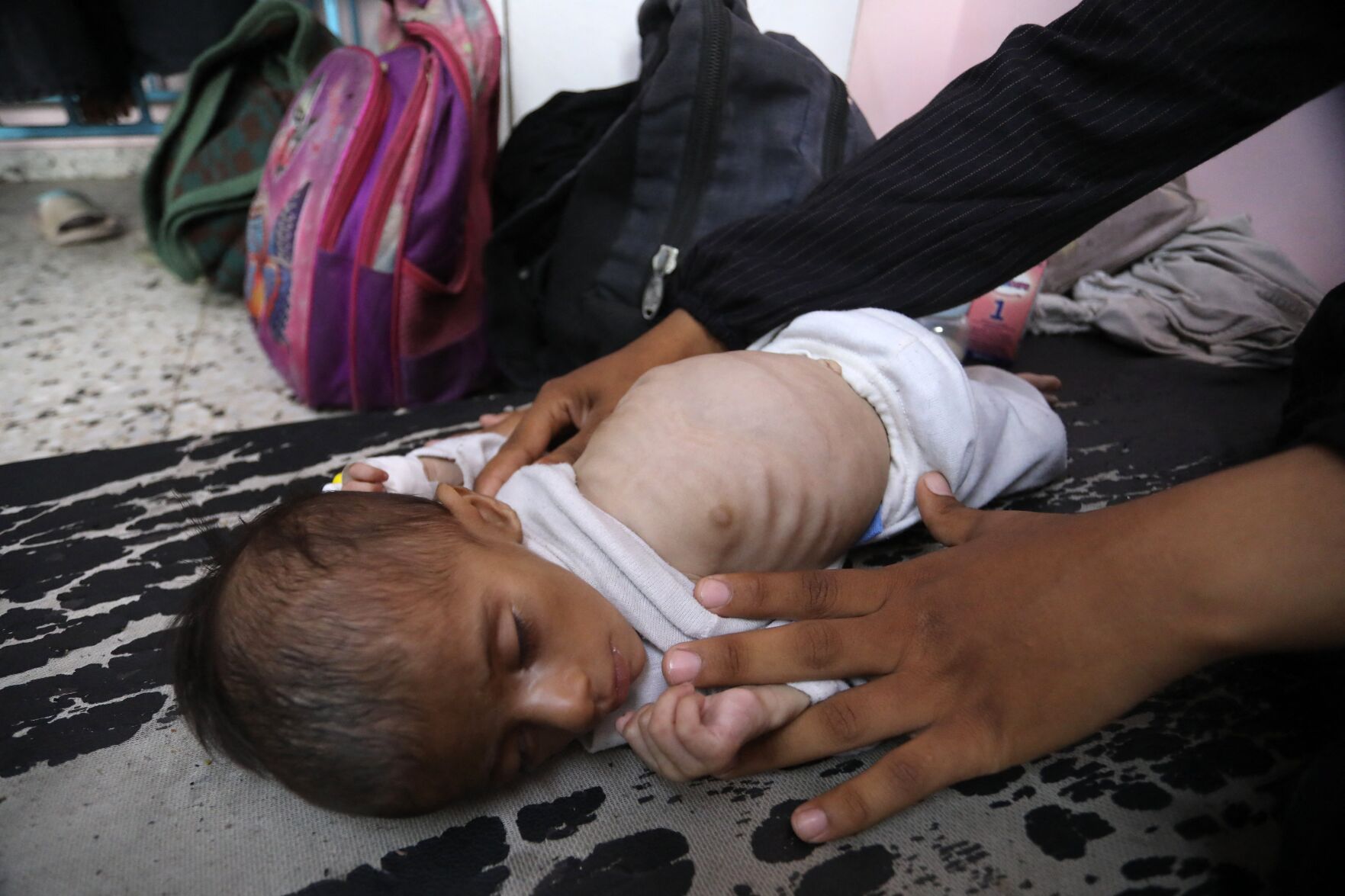 Starving-child-gaza(4).JPG